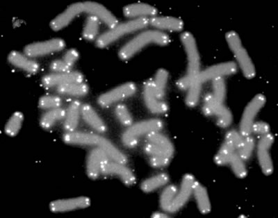 Хромосомы человека (серого цвета) с теломерами (белого цвета)